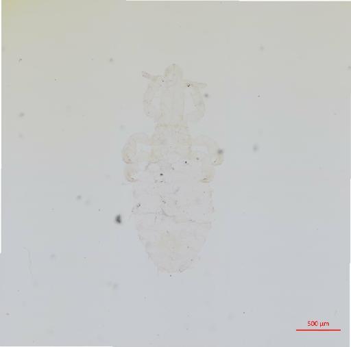 Pedicinus patus Fahrenholz, 1916 - 010700024__2017_08_18-1-Scene-1-ScanRegion0