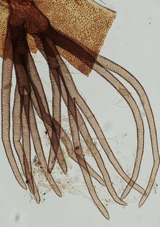 Simulium (Trichodagmia) muiscorum species group Orbitale Bueno et al. - 010195833_S_muiscorum_Pupa_Paratype_gill