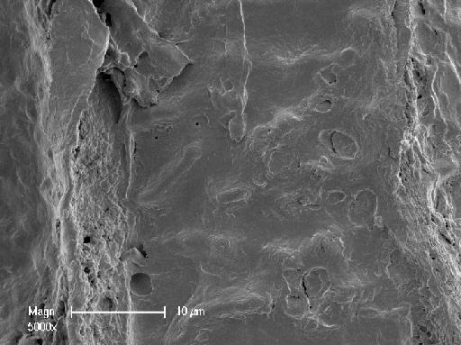 Nitella gelatinifera (R.D.Wood) R.D.Wood - OosporeDetail