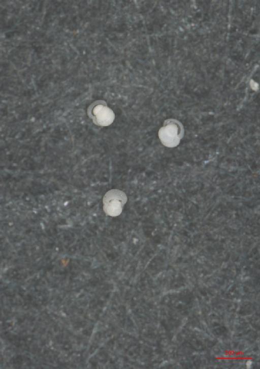Hastigerina pelagica (d'Orbigny) - ZF6764