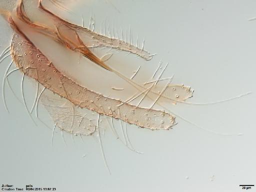 Lutzomyia (Helcocyrtomyia) hartmanni Fairchild & Hertig, 1957 - Lutzomyia_hartmanni-BMNH(E)1722007_PT-male_sperm_duct_apex-20x.tif