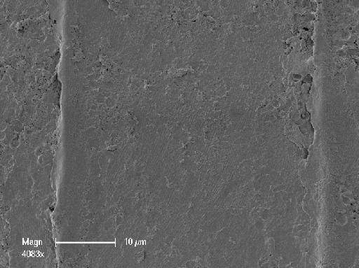 Nitella subtilissima A.Braun - OosporeDetail1