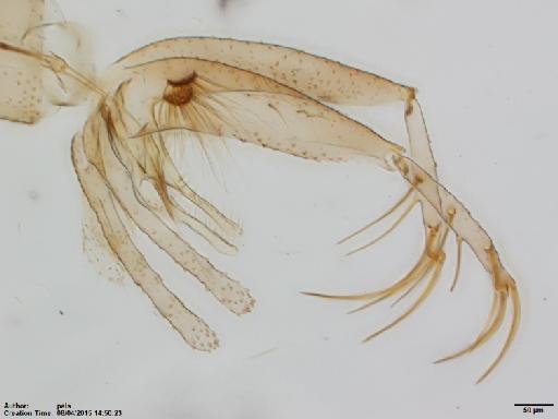 Lutzomyia (Helcocyrtomyia) strictivilla Young, 1979 - Lutzomyia_strictivilla-BMNH(E)1722009_PT-male_terminalia-10x.tif