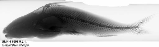Galeichthys feliceps Valenciennes in Cuvier & Valenciennes, 1840 - BMNH 1891.9.3.1, Galeichthys feliceps, Radiograph