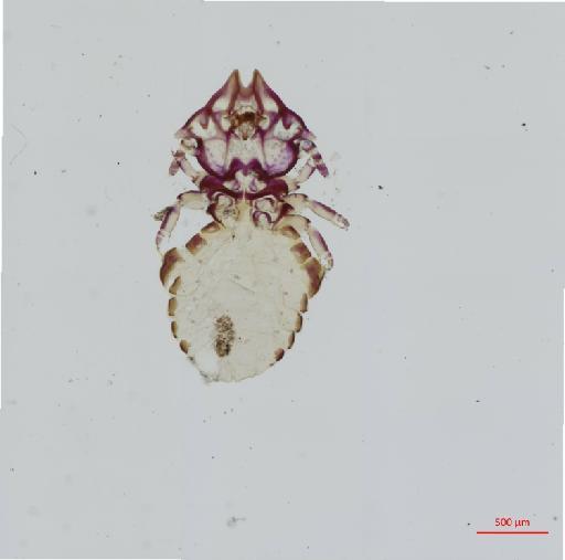 Cebidicola extrarius Werneck, 1950 - 010695861__2017_08_15-Scene-1-ScanRegion0