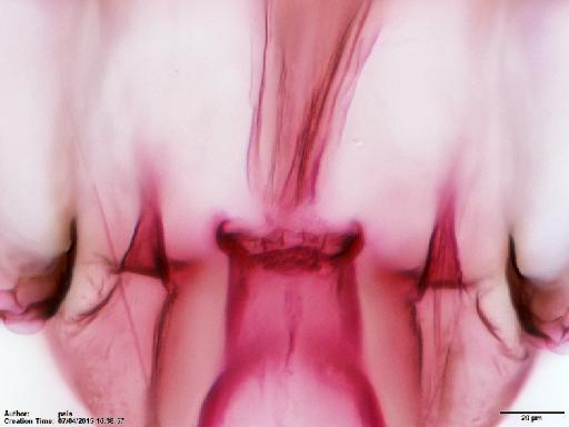 Phlebotomus hansoni Fairchild & Hertig, 1961 - Lutzomyia_hansoni-BMNH(E)1721997_PT-female_cibarium-40x.tif