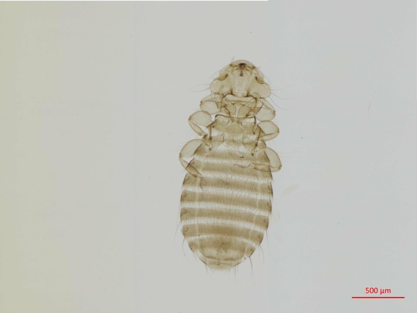 To NHMUK collection (Austromenopon phaeopodis Schrank, 1802; NEOTYPE; NHMUK:ecatalogue:7988731)