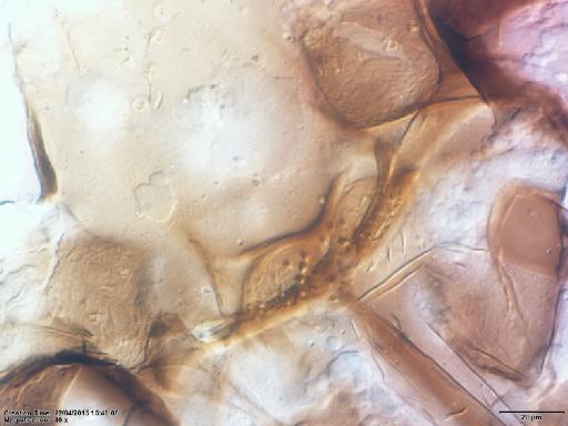 Lutzomyia (Nyssomyia) umbratilis Ward & Fraiha, 1977 - Lutzomyia_umbratilis-BMNH(E)1722058_PT-female_cibarium-40x.tif