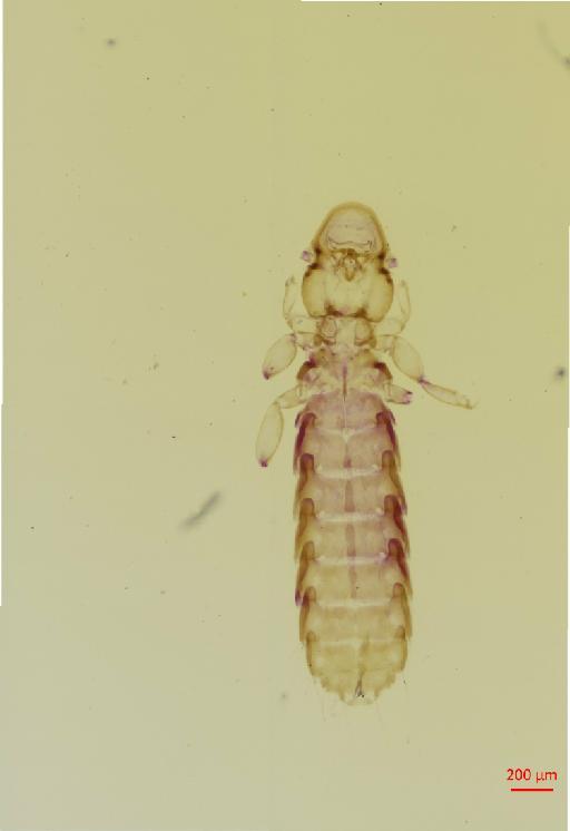 Syrrhaptoecus angulatus Waterston, 1928 - 010694686__2017_08_15-Scene-1-ScanRegion0