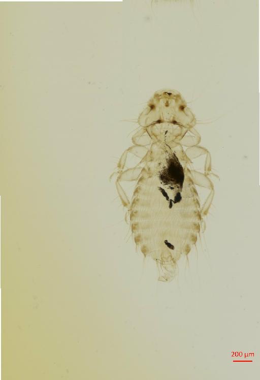 Amyrsidea (Cracimenopon) simplex Carriker, 1950 - 010651179__2017_07_18-Scene-3-ScanRegion2