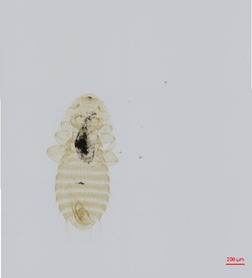 Austromenopon limosae Timmermann, 1954 - 010651891__2017_07_19-Scene-2-ScanRegion1