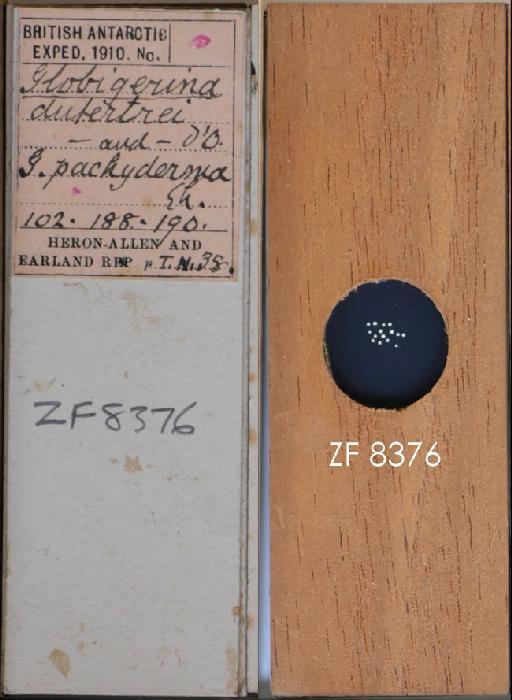 Globigerina dutertrei Orbigny, 1839 - ZF 8376.tif