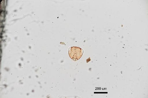 Palaeoneura unimaculatum (Hayat & Anis, 1999) - 010158636_Palaeoneura_unimaculatum_F_HT head x10