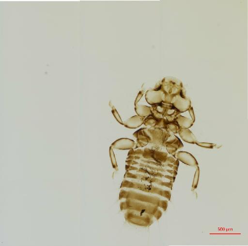 Myrsidea cecilae Klockendoff, 1972 - 010661556__2017_07_24-Scene-1-ScanRegion0