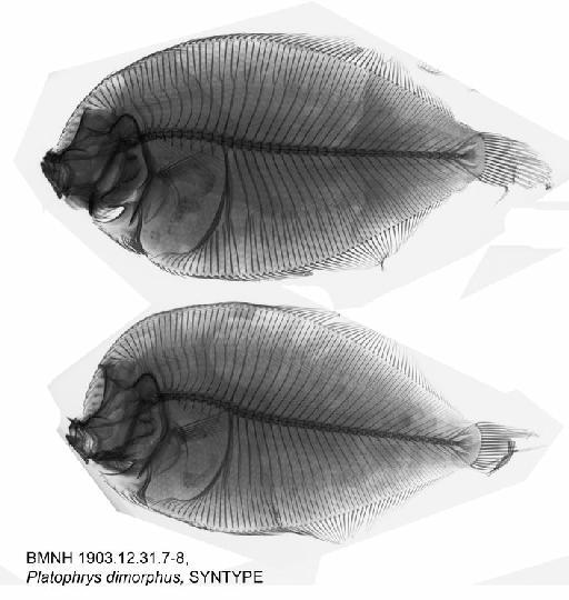 Platophrys dimorphus Gilchrist, 1904 - BMNH 1903.12.31.7-8, Platophrys dimorphus, SYNTYPE, Radiograph