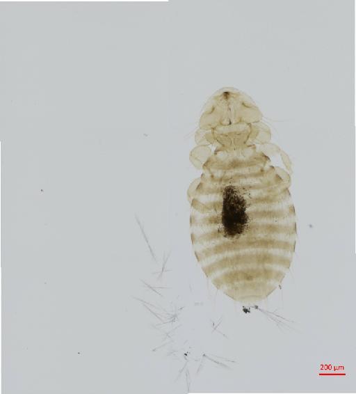 Austromenopon uriae Timmermann, 1954 - 010652224__2017_07_19-Scene-1-ScanRegion0