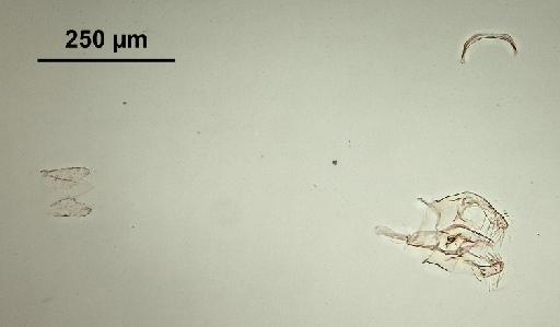 Trichomyia biuncata Duckhouse, 1978 - Trichomyia_biuncata-010210261-genitalia-160_0x-scale