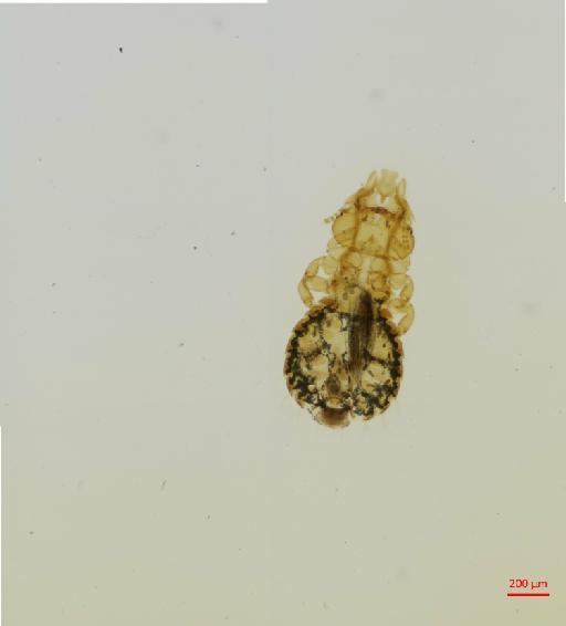 Anatoecus icterodes bipunctatus Giebel, 1874 - 010666894__2017_07_28-Scene-1-ScanRegion0