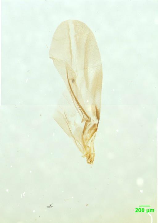 Histeridae Gyllenhal, 1808 - 010189761___10