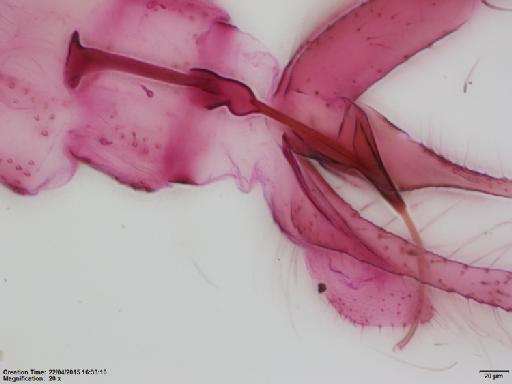 Lutzomyia (Nyssomyia) ylephiletor Fairchild & Hertig, 1952 - Lutzomyia_ylephiletor-BMNH(E)1251315_PT-male_sperm_ducts-20x.tif