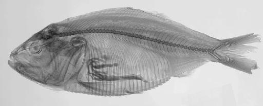 Alosa pectinata Jenyns, 1842 - BMNH 1917.7.25.1, SYNTYPE, Alosa pectinata, radiograph