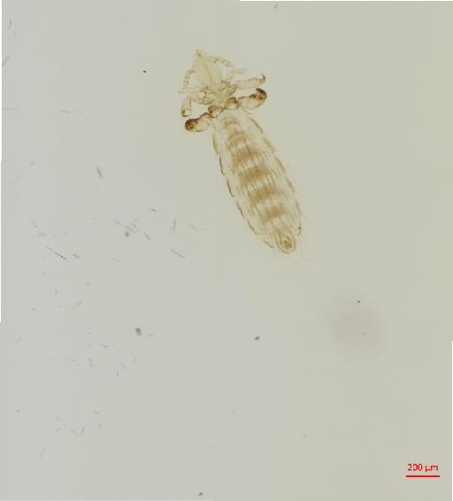 Polyplax oxyrrhynchus Cummings, 1915 - 010155521__2017_08_22-Scene-1-ScanRegion0