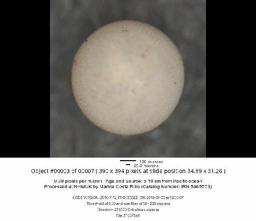 Orbulina universa Orbigny, 1839 - ZF6573-Orbulina-universa_obj00003_plane000.jpg