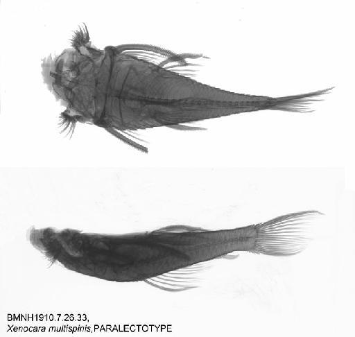 Xenocara multispinis Regan, 1912 - BMNH 1910.7.26.33, PARALECTOTYPE, Xenocara multispinis