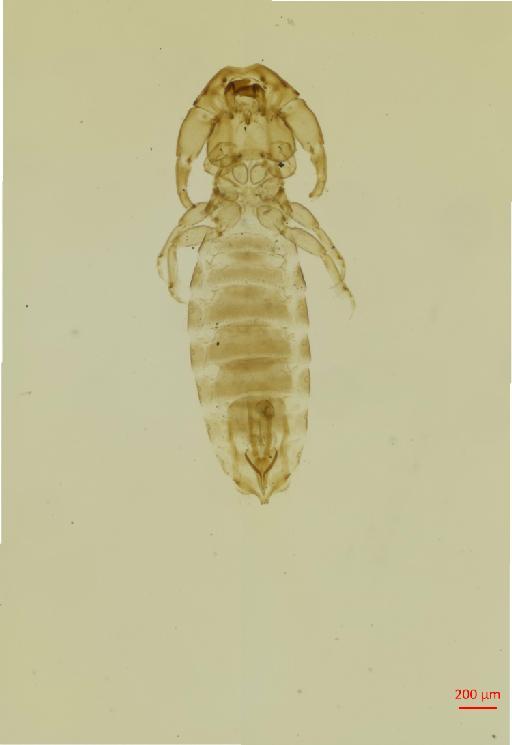 Tricholipeurus lipeuroides Megnin, 1884 - 010698112__2017_08_17-Scene-1-ScanRegion0