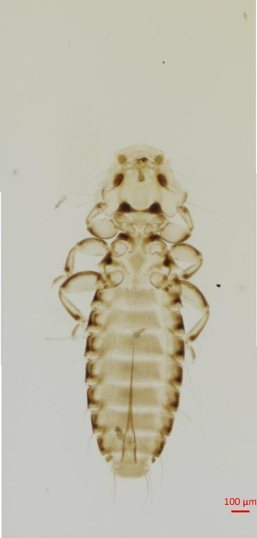 Actornithophilus crinitus Clay, 1962 - 010649804__2017_07_18-Scene-2-ScanRegion1