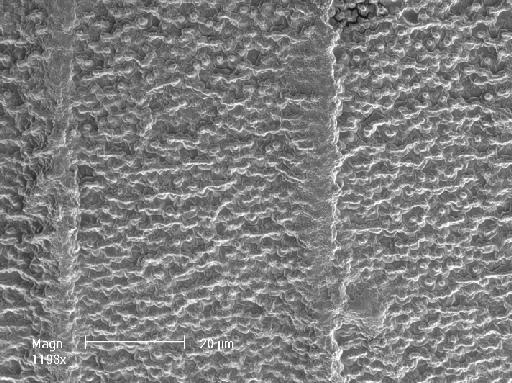 Nitella pseudoflabellata var. vermiculata (J.Groves) C.Agardh - OosporeDetail