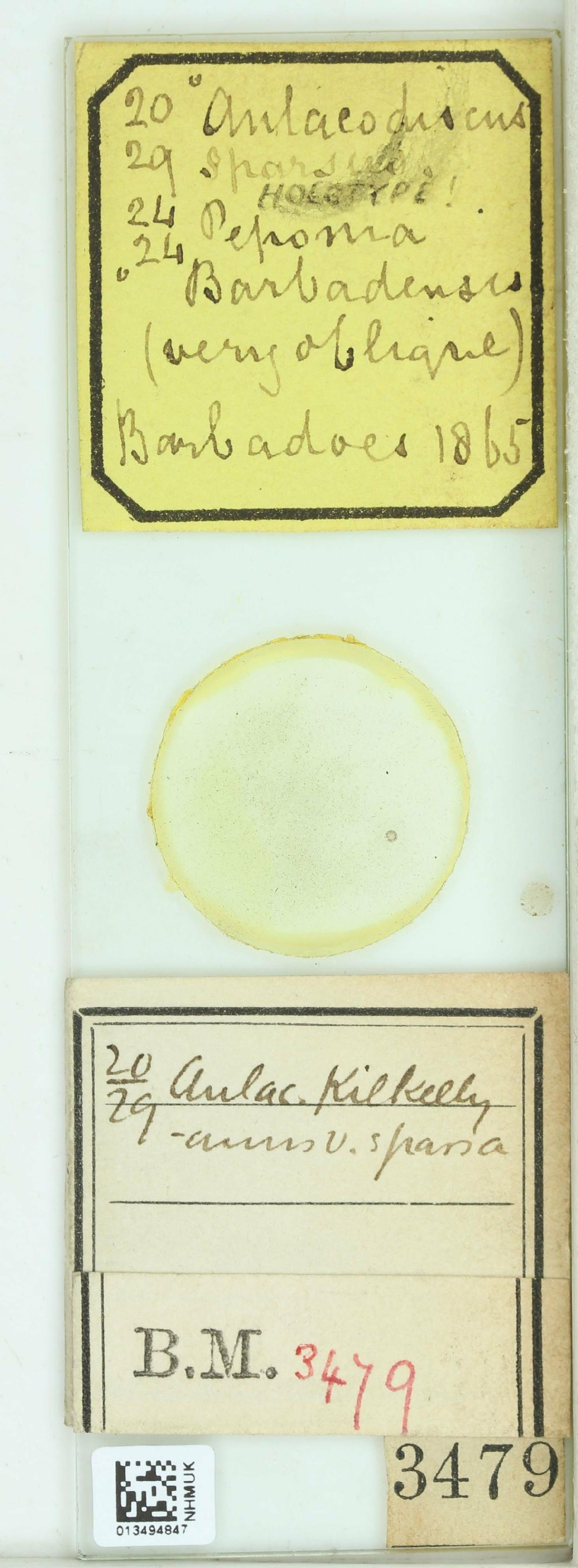 To NHMUK collection (Aulacodiscus sparsus Grev.; Holotype; NHMUK:ecatalogue:4741013)