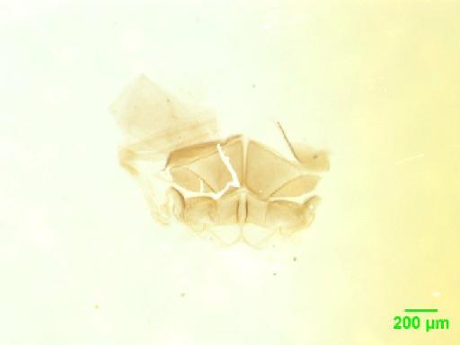 Histeridae Gyllenhal, 1808 - 010189510___12