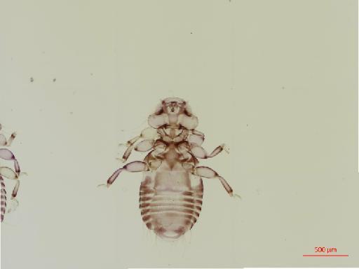 Myrsidea grandiceps macrorhynchicola Klockenhoff, 1971 - 010661949__2017_07_24-Scene-2-ScanRegion1