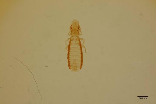 Ricinus intermedius Uchida, 1915 - 010710125_specimen