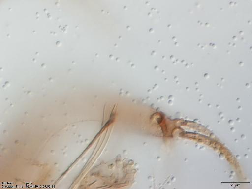 Phlebotomus trinidadensis Newstead, 1922 - Lutzomyia_trinidadensis-BMNH(E)1721999_ST-male_sperm_duct_apex-40x.tif