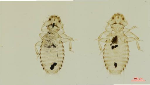 Amyrsidea (Cracimenopon) simplex Carriker, 1950 - 010651179__2017_07_18-Scene-2-ScanRegion1