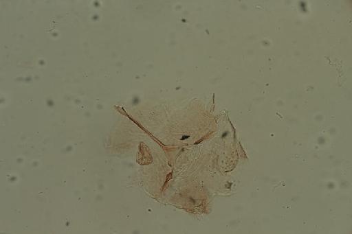 Simulium (Anasolen) masabae Gibbins, 1934 - 010195943_Simulium_Anasolen_masabae_genital fork