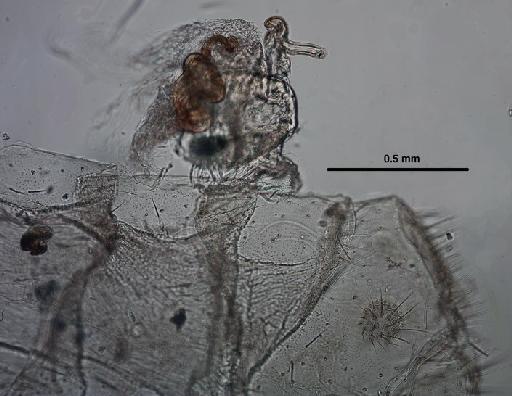 Nodita diversa Walker - Chrysopa diversa BMNHE 1241757 genitalia1