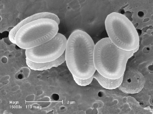 Algirosphaera robusta - 117(ex113)-1.TIF