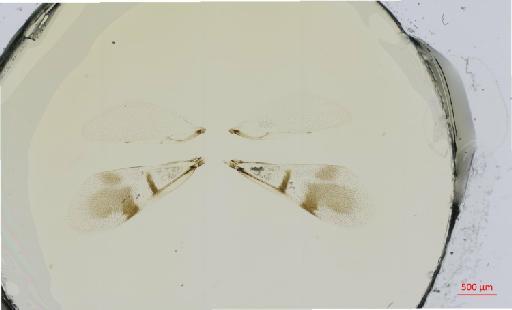 Hexacladia maryae Noyes, 2010 - 010178956__2017_01_31-Scene-1-ScanRegion0