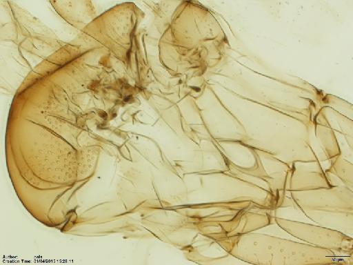 Lutzomyia (Coromyia) isovespertilionis Fairchild & Hertig, 1958 - Lutzomyia_isovespertilionis-BMNHH(E)1721986_PT-male_thorax-10x.tif