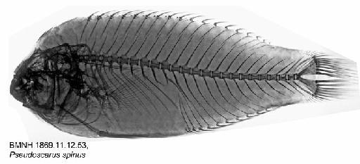 Pseudoscarus spinus Kner, 1868 - BMNH 1869.11.12.53, Pseudoscarus spinus, Radiograph