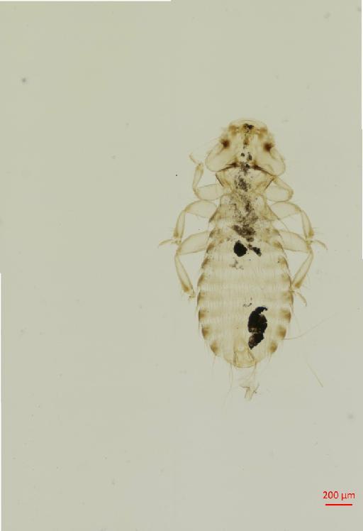 Amyrsidea (Cracimenopon) simplex Carriker, 1950 - 010651179__2017_07_18-Scene-4-ScanRegion3