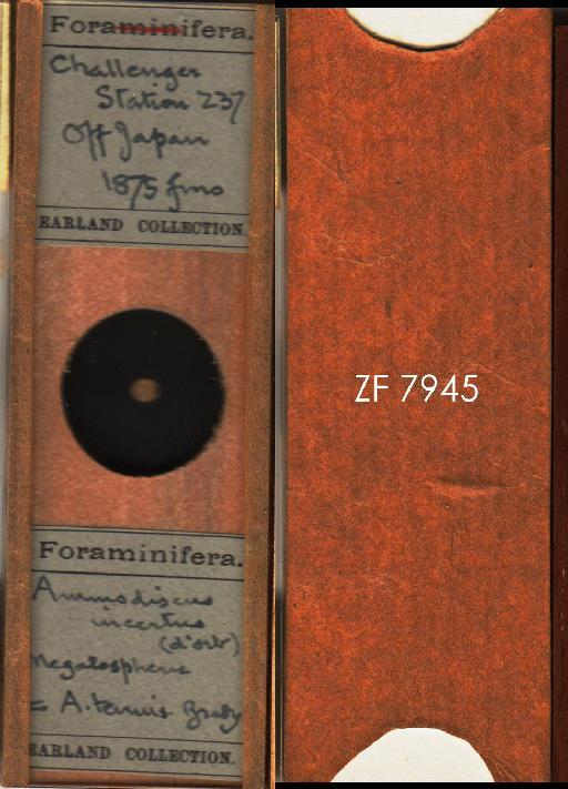Ammodiscus incertus (d'Orbigny 1839) - ZF 7945.tif