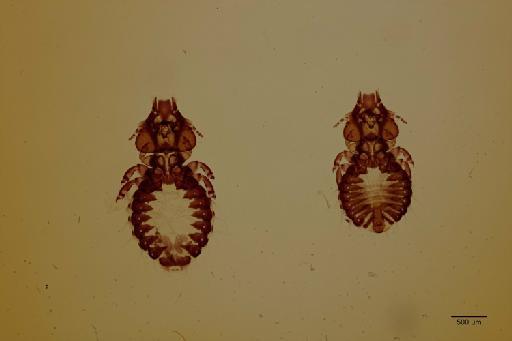 Craspedorrhynchus spathulatus Giebel, 1874 - 010673870_specimen