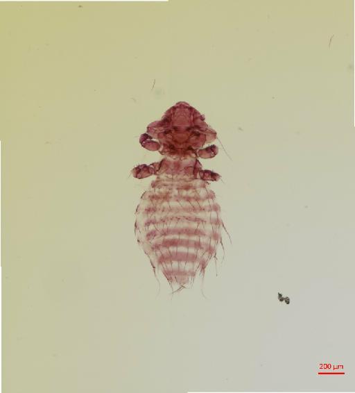 Boopia brevispinosa Harrison & Johnston, 1916 - 010648780__2017_07_17-Scene-1-ScanRegion0