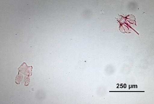 Trichomyia bulbosa Duckhouse, 1978 - Trichomyia_bulbosa-010210262-genitalia-160_0x-scale