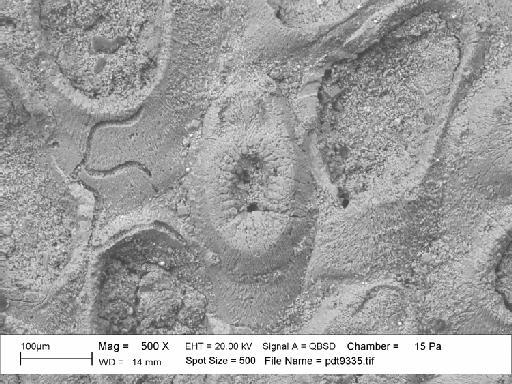 Charixa sexspinata Martha et al., 2019 - PI BZ 7895 - Charixa sexspinata