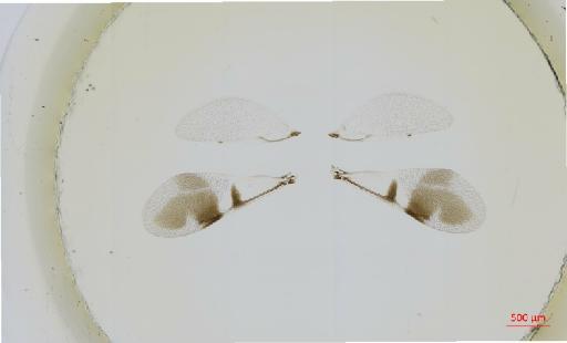 Hexacladia mantua Noyes, 2010 - 010178952__2017_01_31-Scene-1-ScanRegion0